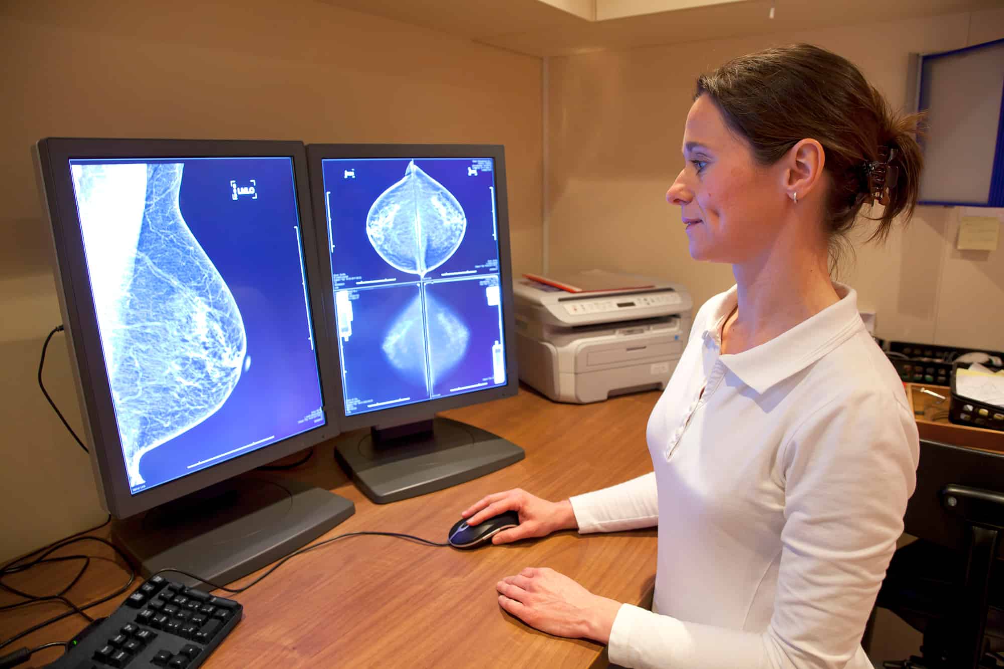 Top Technologies Improving Breast Cancer Screening Today